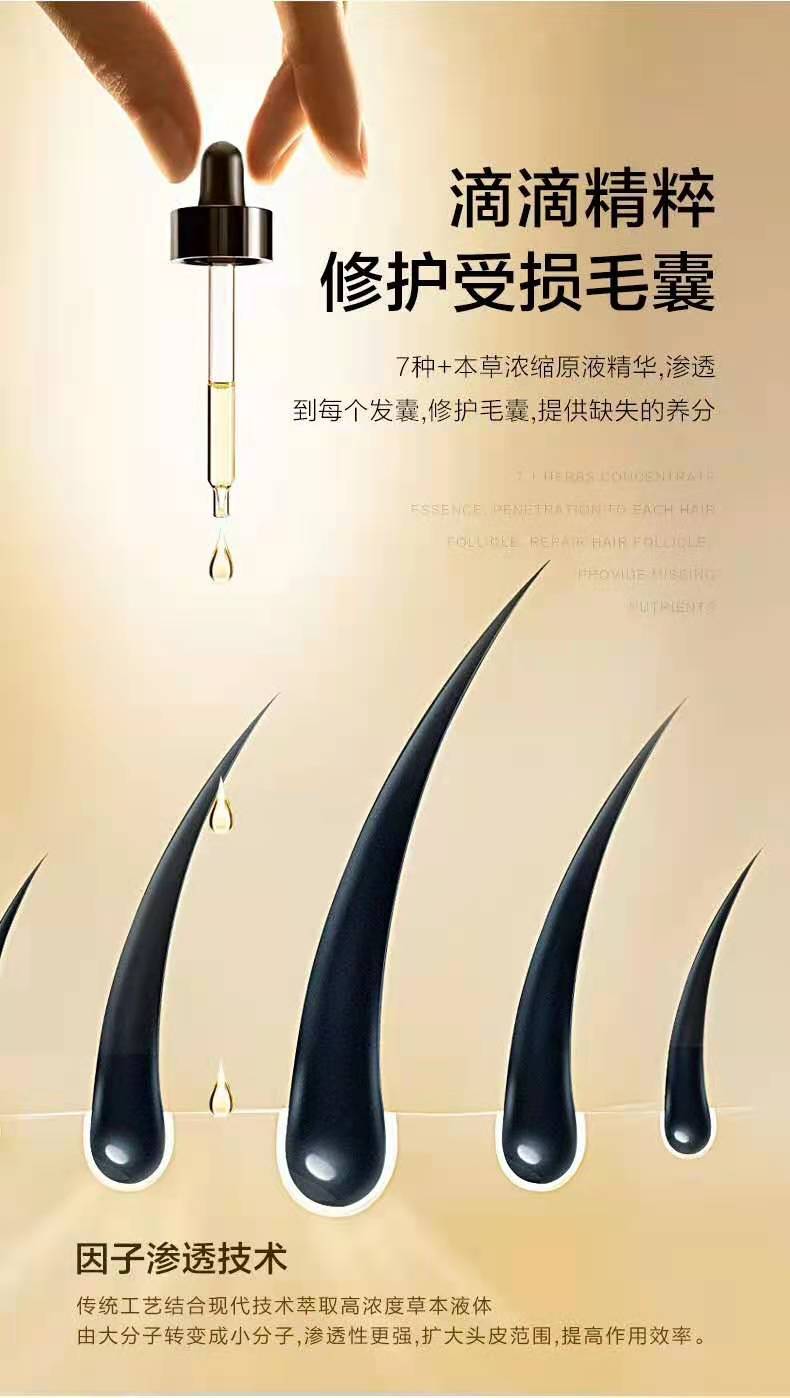 冬天养发注意事项